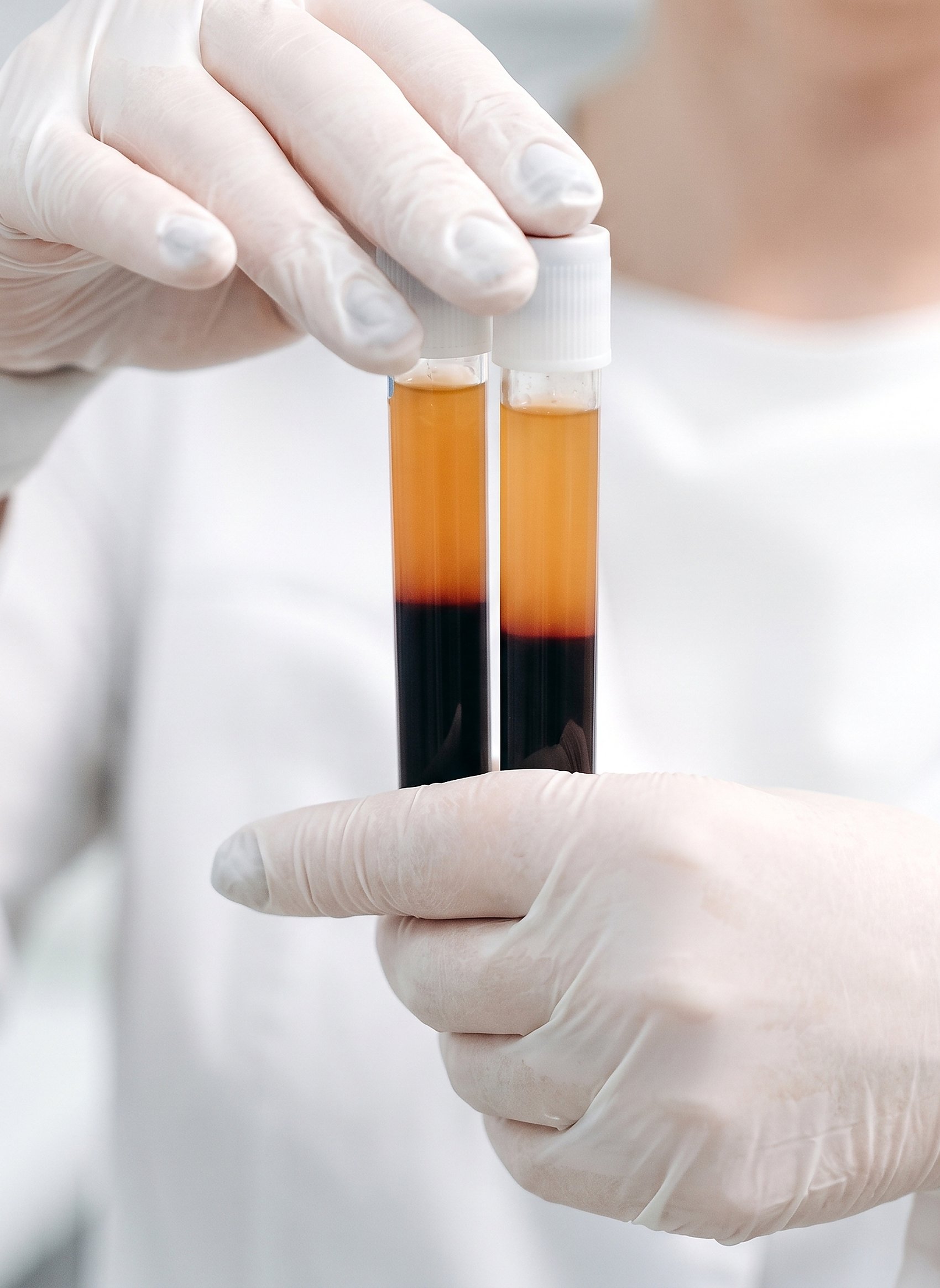 Blood samples prepared for lab review at Citrin Longevity in West Hollywood, the bi-monthly clinical frequency in the Elevate membership
